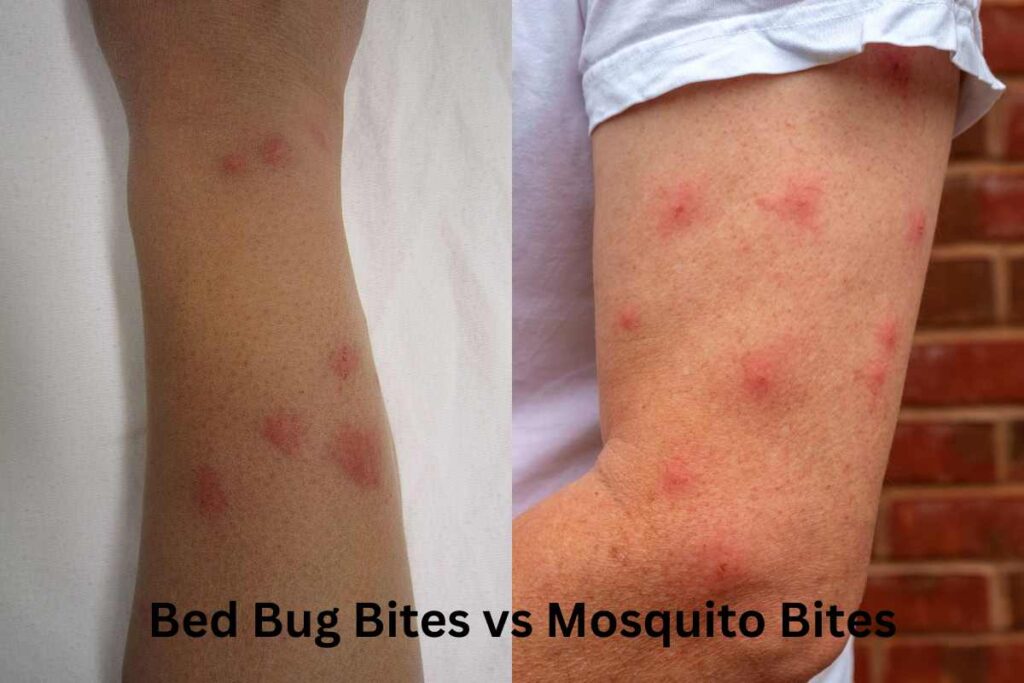 Bed Bug Bites vs. Mosquito Bites How to Identify Them Lotusmagus